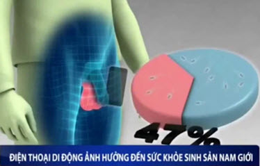 Bức xạ điện từ ảnh hưởng chất lượng tinh trung của nam giới gây vô sinh